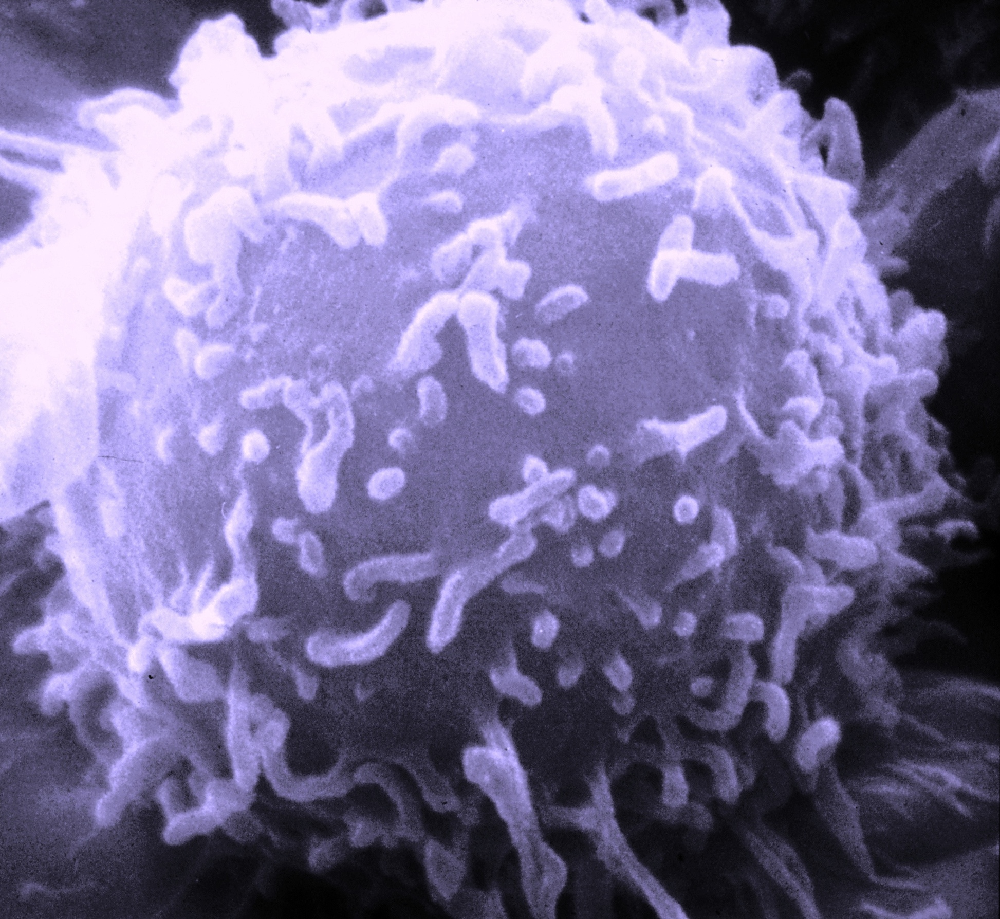 Autophagy in Cardiovascular Aging is a Complicated Matter