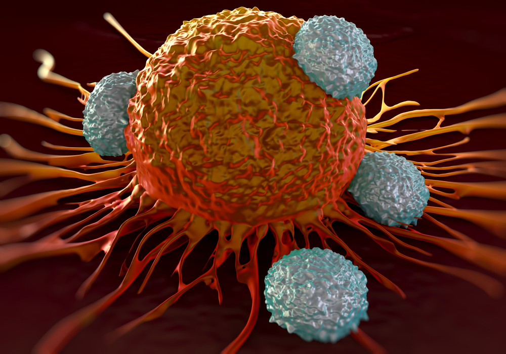 Significant association between income and survival after surgery for lung cancer