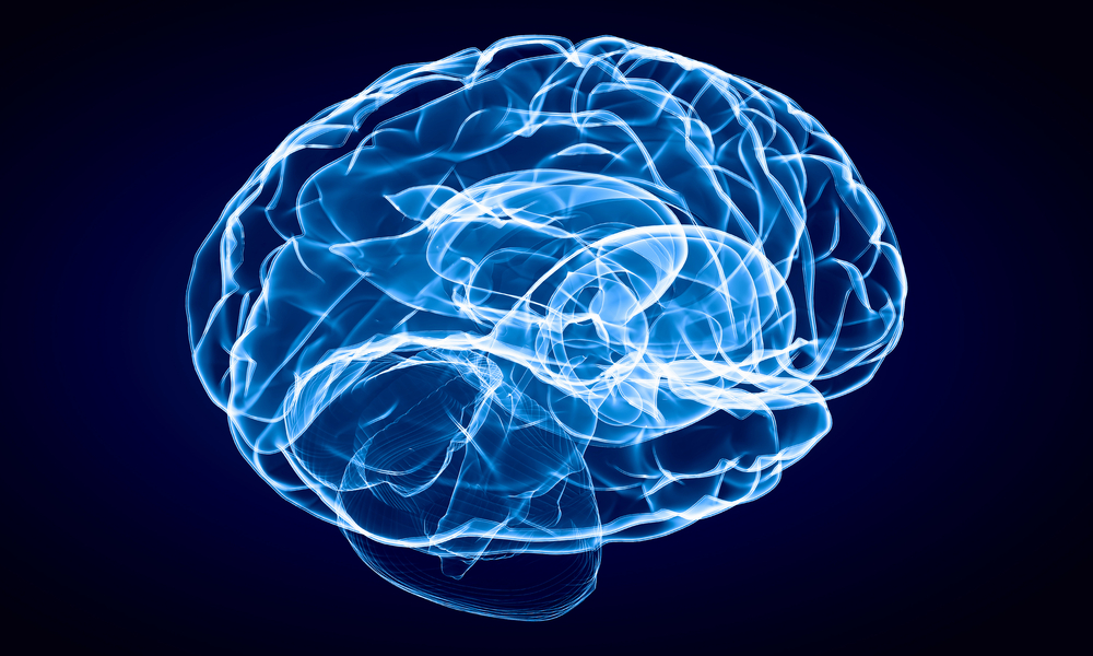 Protein Aggregates of Alzheimer's Disease Observed in Aged Dolphins