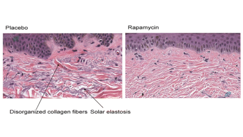 Rapamycin skin