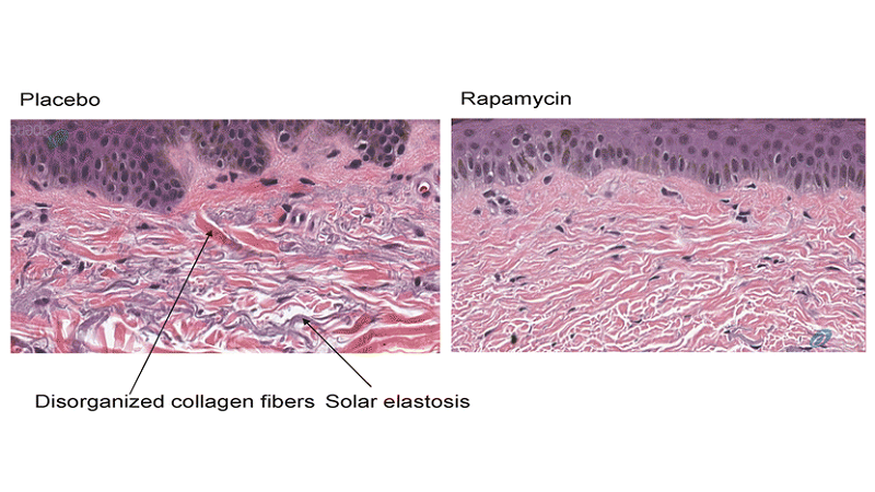 Rapamycin skin