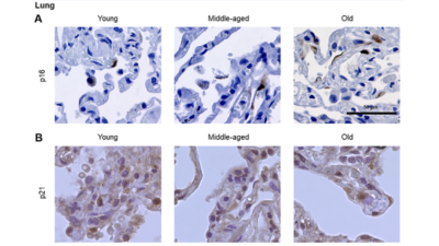 Lung senescence tissue markers
