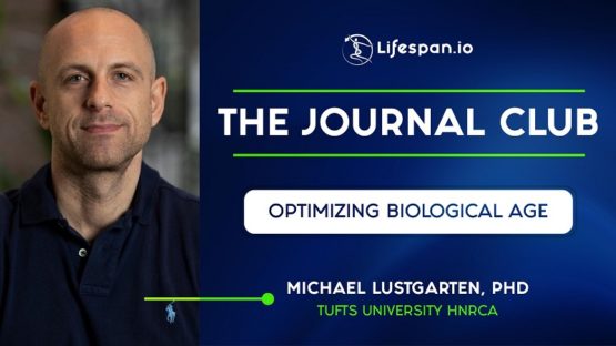 Journal Club Michael Lustgarten