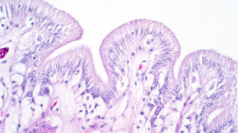 Intestinal lining under a microscope