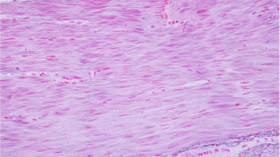 Microscope image of smooth muscle cells