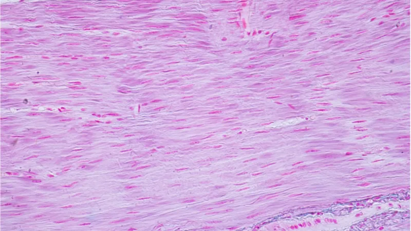 Microscope image of smooth muscle cells