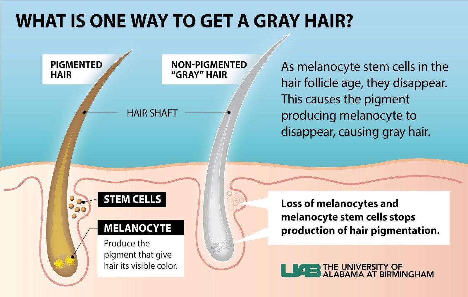 Causes and Solutions for Gray Hair Causes and Solutions for Gray Hair