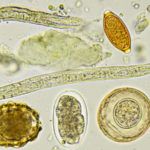 显微镜下的寄生虫