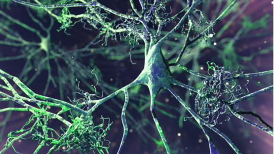 Amyloid tangles