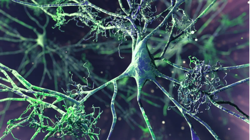 Amyloid tangles