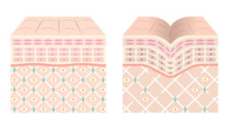 Collagen