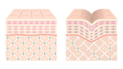 Collagen