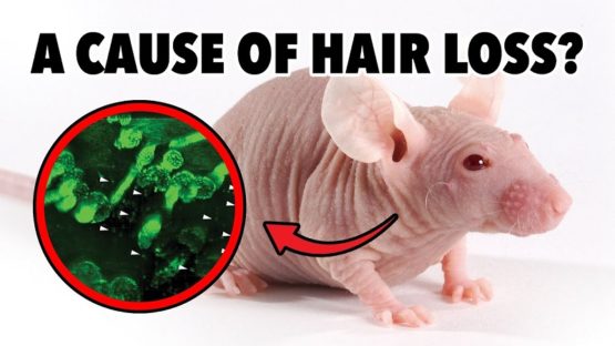 LSN Hair Loss