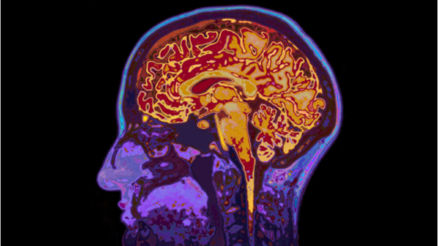 Brain Image