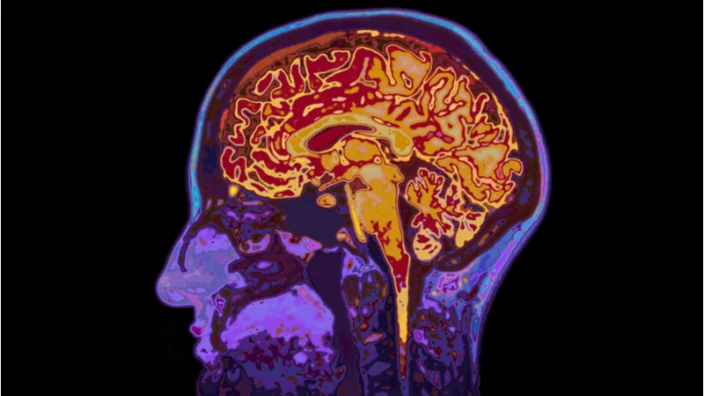 Brain Image