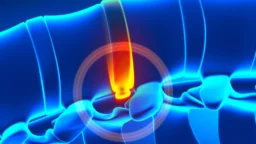 Spinal disc