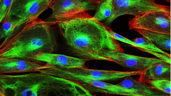 Fluorescent cells