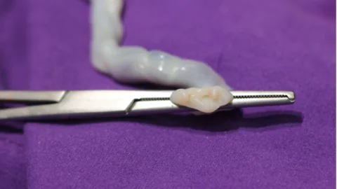 Umbilical Cord
