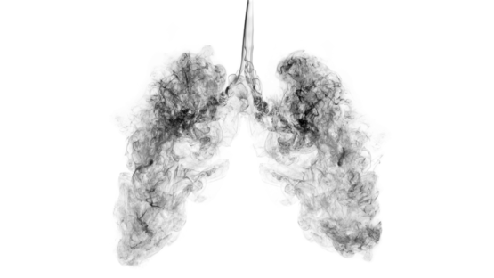 Polluted lungs