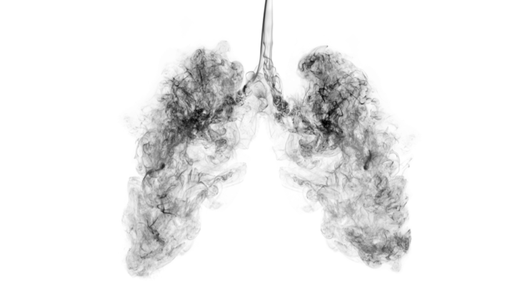 Air Pollution Harms Immune Function in Lungs