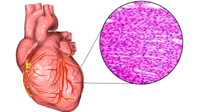Heart cells