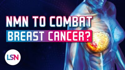 NMN Breast Cancer