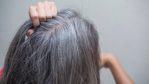 Gray hair