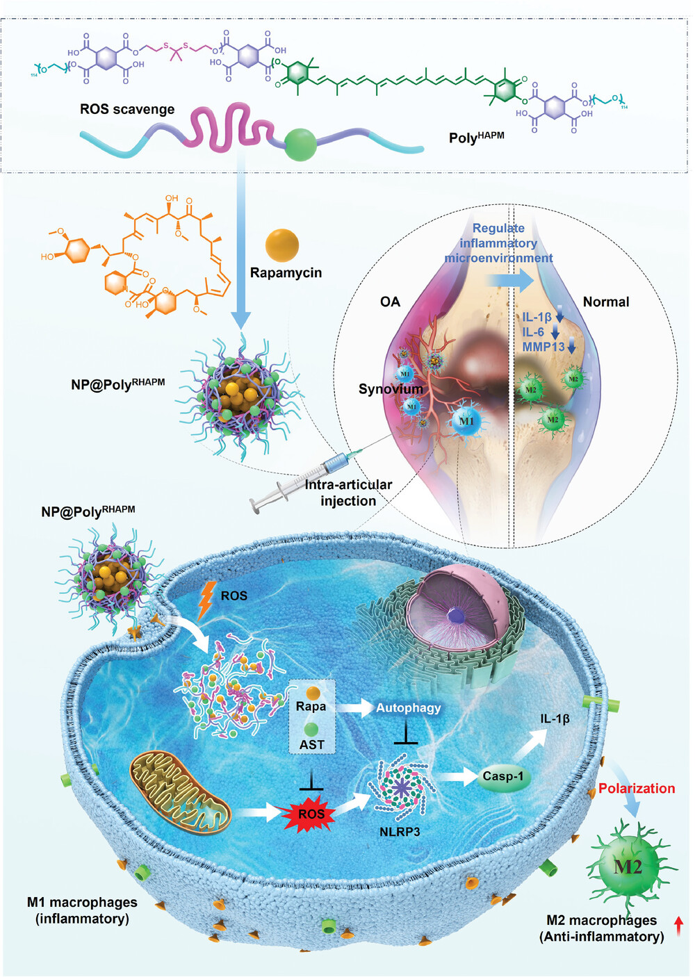 Osteoarthritis Nanoparticles