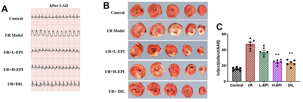 Reperfusion injury