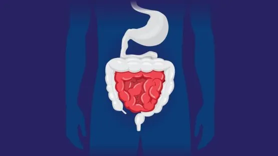 Intestine