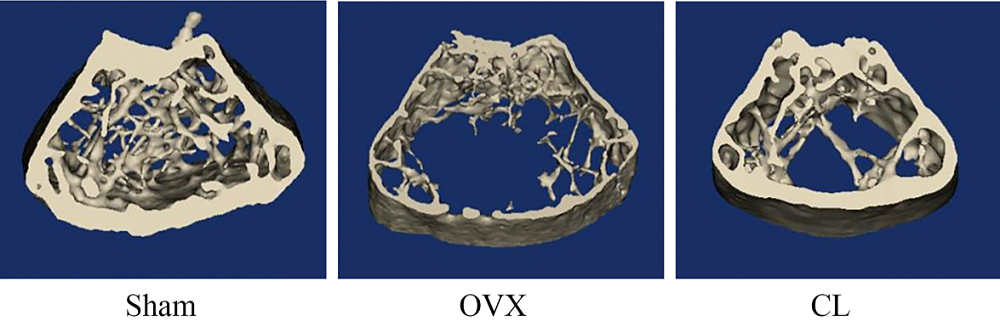 Corylin bone loss