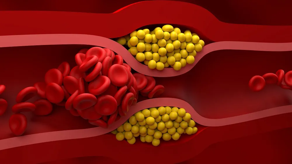 Cyclarity Begins Phase 1 Trial for Heart Disease