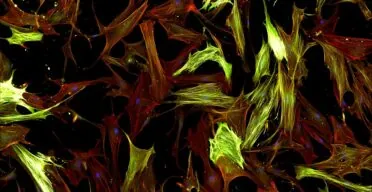 Using a Surface Biomarker to Target Senescent Cells