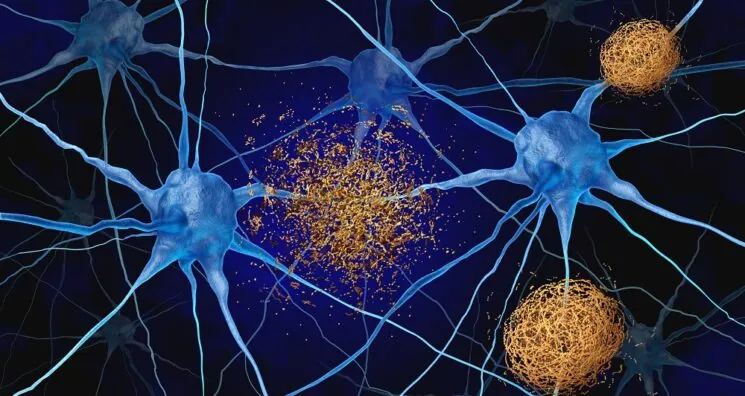 Nanostructures Trap Amyloid Beta, Rescuing Neurons