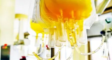 How Plasma Exchange Affects Aging in a Human Trial