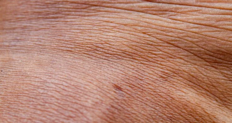 A New Approach to Treating Aging Skin