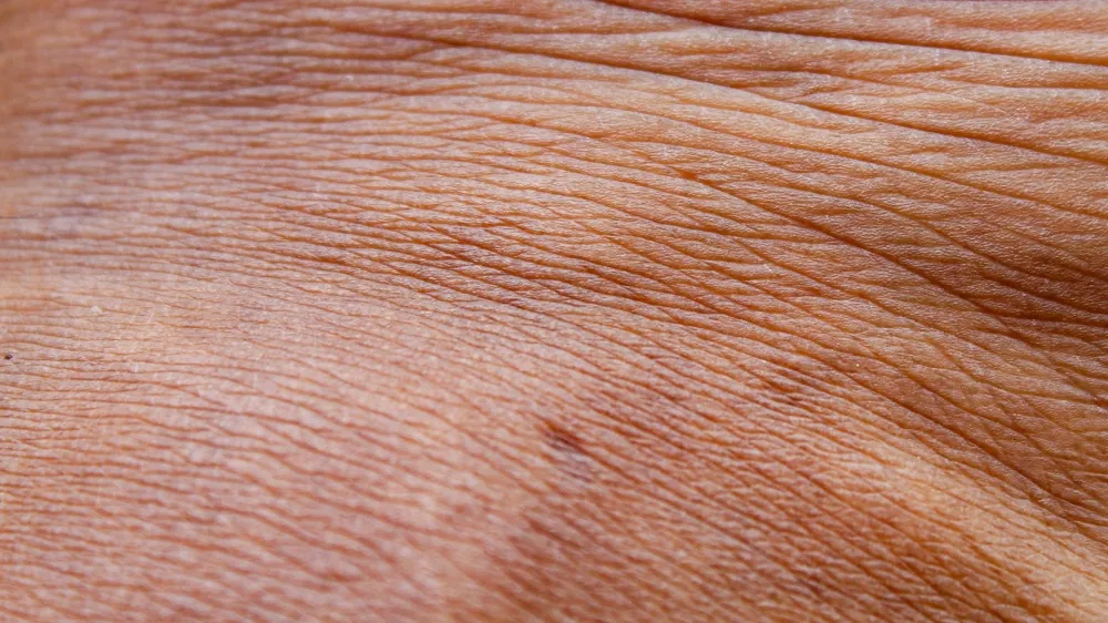 A New Approach to Treating Aging Skin