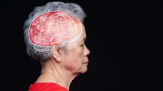 Older woman's brain