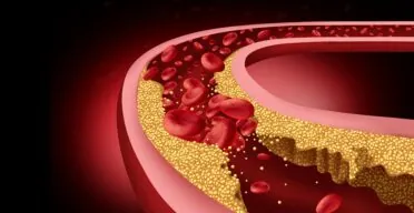 Rejuvenating Atherosclerotic Foam Cells