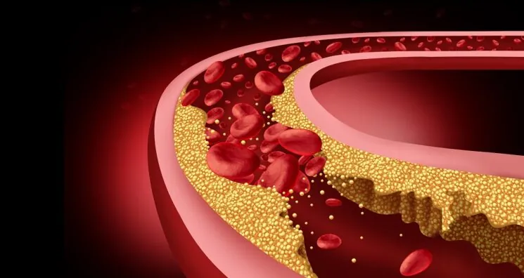 Rejuvenating Atherosclerotic Foam Cells