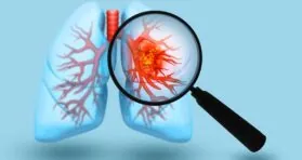 Mitochondria Transplant Improves Chemotherapy in Lung Cancer