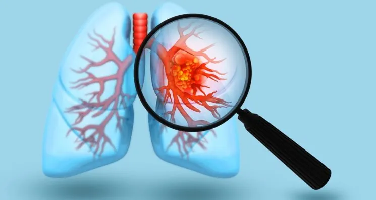 Mitochondria Transplant Improves Chemotherapy in Lung Cancer