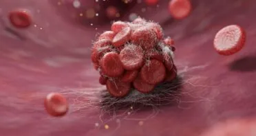 A Potential Reason Why Clotting Increases With Age