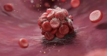 A Potential Reason Why Clotting Increases With Age