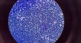 Review Links Lingering Infections to Senescence