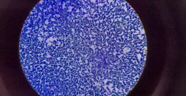 Review Links Lingering Infections to Senescence