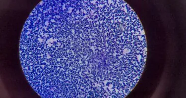 Review Links Lingering Infections to Senescence