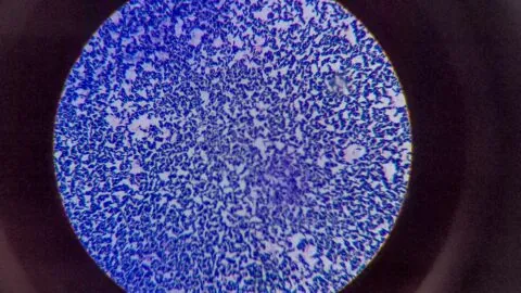 Bacteria under microscope