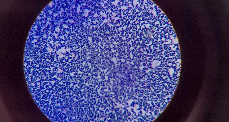 Review Links Lingering Infections to Senescence