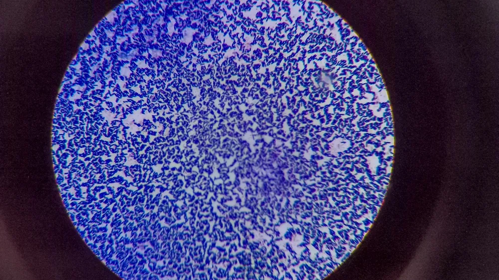 Bacteria under microscope